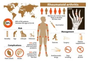 Rheumatoid arthritis management tips